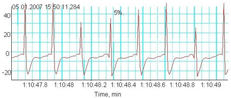 Fig. 2b